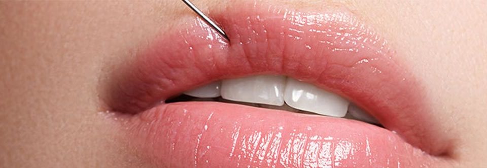 Labios de mujer en tratamiento de relleno
