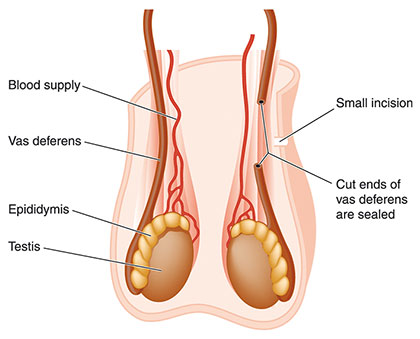 Cirugías urológicas