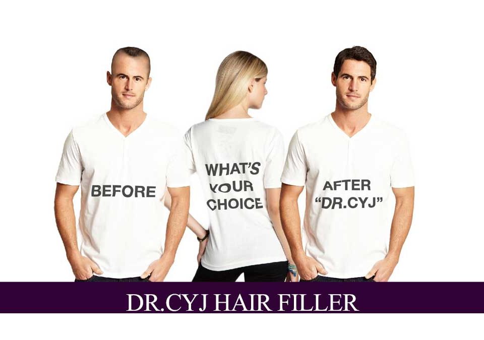 dr cyj hair filler opiniones